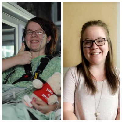Illustrative photo: Megan Rosie two-time organ donor Alberta