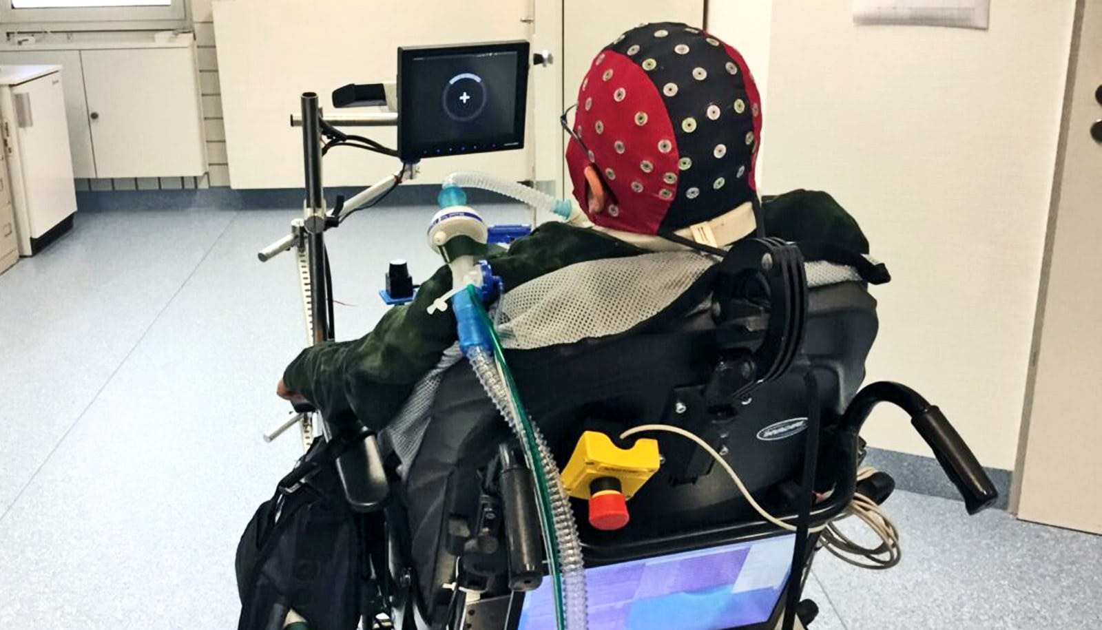 Illustrative photo: brain computer interface paralyzed patient
